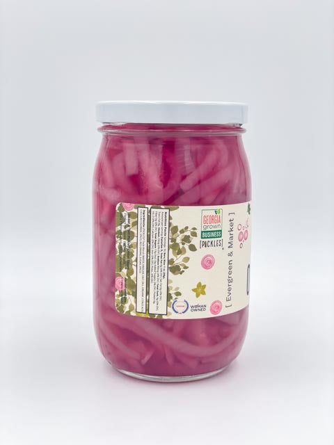 Tangy Pickled Red Onions - Ideal for Tacos and Burgers